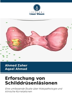 Paperback Erforschung von Schilddrüsenläsionen [German] Book
