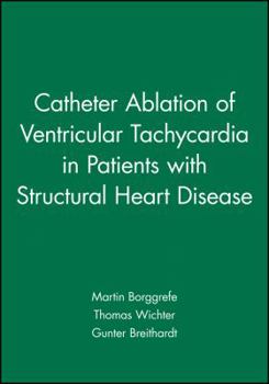 Paperback Catheter Ablation of Ventricular Tachycardia in Patients with Structural Heart Disease Book
