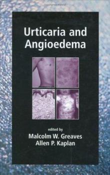 Hardcover Urticaria and Angioedema Book