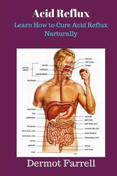 Paperback Acid Reflux: Learn How to Cure Acid Reflux Naturally Book