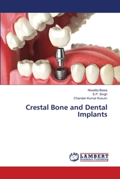 Paperback Crestal Bone and Dental Implants Book