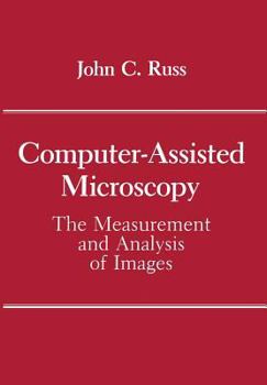 Paperback Computer-Assisted Microscopy: The Measurement and Analysis of Images Book