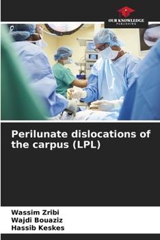 Paperback Perilunate dislocations of the carpus (LPL) Book