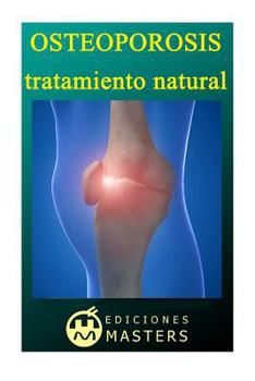 Paperback Osteoporosis: Tratamiento natural [Spanish] Book