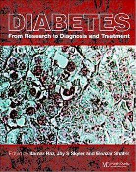 Hardcover Diabetes: From Research to Diagnosis and Treatment Book