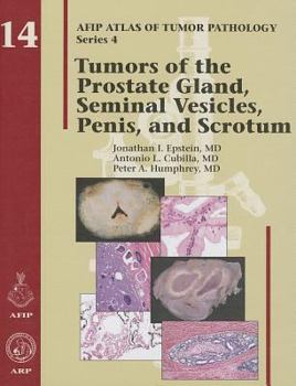 Hardcover Tumors of the Prostate Gland, Seminal Vesicles, Penis, and Scrotum Book
