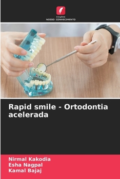 Paperback Rapid smile - Ortodontia acelerada [Portuguese] Book