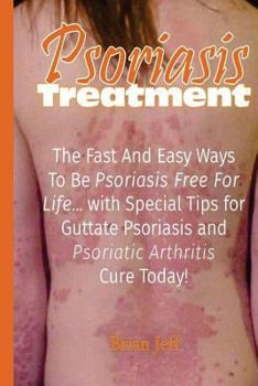 Paperback Psoriasis Treatment: The Fast and Easy Ways to Be Psoriasis Free for Life... with Special Tips for Guttate Psoriasis and Psoriatic Arthriti Book