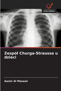 Zespól Churga-Straussa u dzieci (Polish Edition)