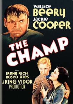 DVD The Champ Book