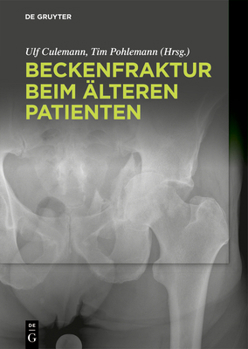 Hardcover Beckenfraktur beim älteren Patienten [German] Book