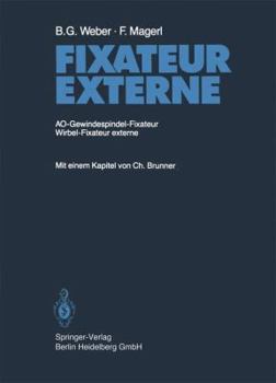 Paperback Fixateur Externe: Ao-Gewindespindel-Fixateur Wirbel-Fixateur Externe [German] Book