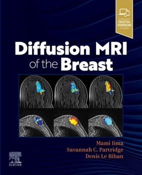 Paperback Diffusion MRI of the Breast Book