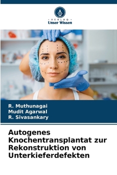 Paperback Autogenes Knochentransplantat zur Rekonstruktion von Unterkieferdefekten [German] Book