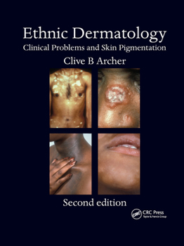 Ethnic Dermatology: Clinical Problems and Pigmented Skin