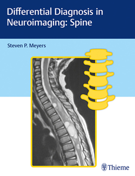 Hardcover Differential Diagnosis in Neuroimaging: Spine Book