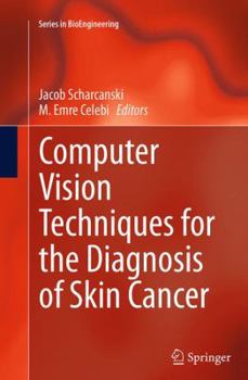 Paperback Computer Vision Techniques for the Diagnosis of Skin Cancer Book