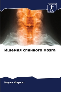 Paperback Ишемия спинного мозга [Russian] Book
