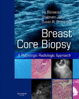 Hardcover Breast Core Biopsy: A Pathologic-Radiologic Approach Book