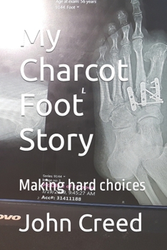 Paperback My Charcot Foot Story: Making hard choices Book