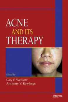 Hardcover Acne and Its Therapy Book