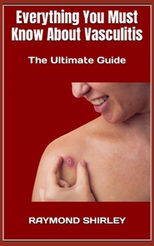 Paperback Everything You Must Know About Vasculitis: The Ultimate Guide Book