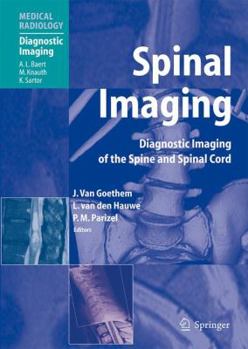 Spinal Imaging: Diagnostic Imaging of the Spine and Spinal Cord (Medical Radiology / Diagnostic Imaging)