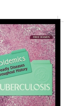 Paperback Tuberculosis Book