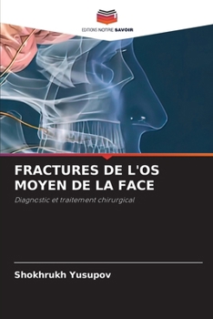 Paperback Fractures de l'Os Moyen de la Face [French] Book
