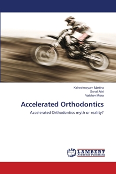 Paperback Accelerated Orthodontics Book