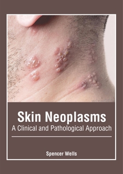 Hardcover Skin Neoplasms: A Clinical and Pathological Approach Book