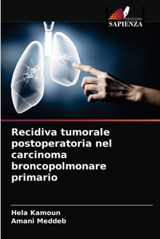 Paperback Recidiva tumorale postoperatoria nel carcinoma broncopolmonare primario [Italian] Book