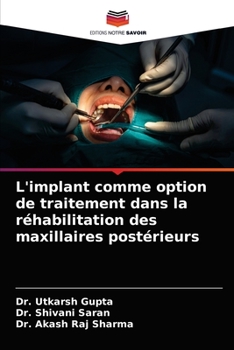 Paperback L'implant comme option de traitement dans la réhabilitation des maxillaires postérieurs [French] Book