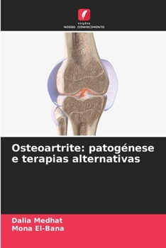 Paperback Osteoartrite: patogénese e terapias alternativas [Portuguese] Book