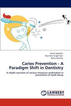 Paperback Caries Prevention - A Paradigm Shift in Dentistry Book