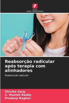 Paperback Reabsorção radicular após terapia com alinhadores [Portuguese] Book