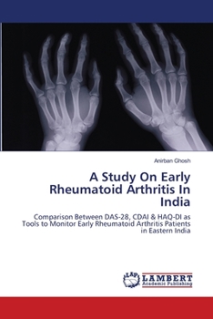 Paperback A Study On Early Rheumatoid Arthritis In India Book