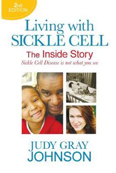 Paperback Living With Sickle Cell - The Inside Story: Sickle Cell Disease is Not What You See Book