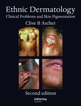 Hardcover Ethnic Dermatology: Clinical Problems and Skin Pigmentation Book