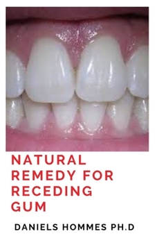 Natural Remedy for Receding Gum: How to Heal Cavities and Reverse Gum Disease Naturally: DIY Home Remedies that Work