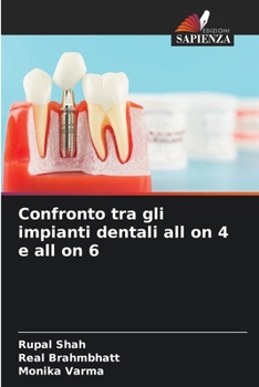 Paperback Confronto tra gli impianti dentali all on 4 e all on 6 [Italian] Book