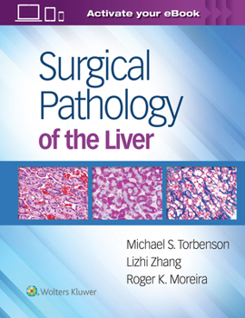 Hardcover Surgical Pathology of the Liver Book
