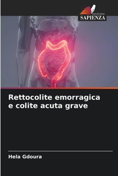 Paperback Rettocolite emorragica e colite acuta grave [Italian] Book