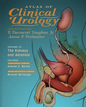 Hardcover Atlas of Clinical Urology: The Kidneys and Adrenals Book
