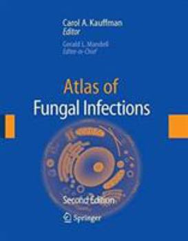 Audio CD Atlas of Fungal Infection Book