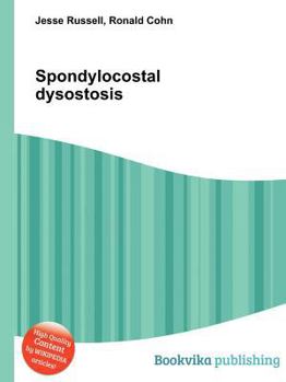 Paperback Spondylocostal Dysostosis Book