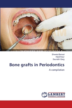 Paperback Bone grafts in Periodontics Book