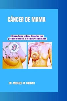 CÁNCER DE MAMA: Empoderar vidas, desafiar las probabilidades e inspirar esperanza (Staying Healthy and Hope for Better Tomorrow Series) (Spanish Edition)