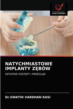 Paperback Natychmiastowe Implanty ZĘbów [Polish] Book