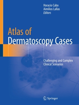 Paperback Atlas of Dermatoscopy Cases: Challenging and Complex Clinical Scenarios Book